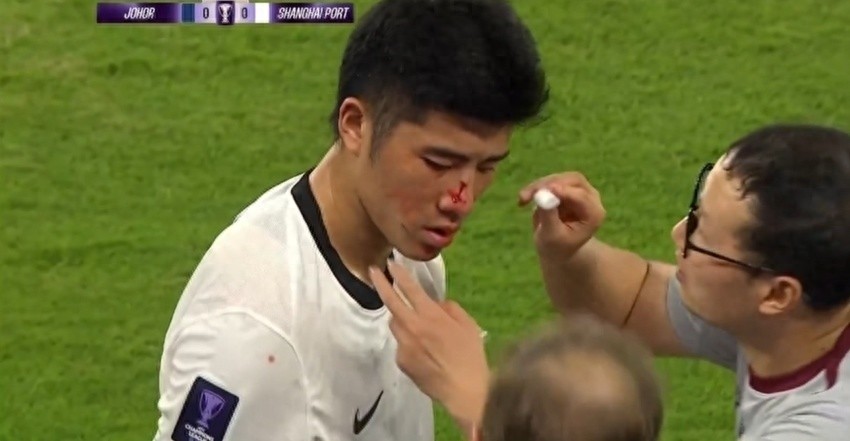 亚冠巨大争议!李圣龙被踩破相,对手恶劣动作逃红,记者开炮